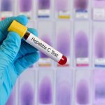 Alertă la Timișoara: Crește numărul cazurilor de hepatită A, transmitere extinsă în familii