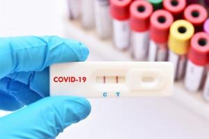 Rata de infectare cu coronavirus în Timişoara și județ, în scădere