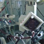 Spitalul „Dr. Victor Babeș”, inclus în programul național prin care se finanțează folosirea „plămânu...