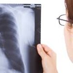 România, în topul îngrijorător al tuberculozei în UE: un nou caz la fiecare oră și decese zilnice